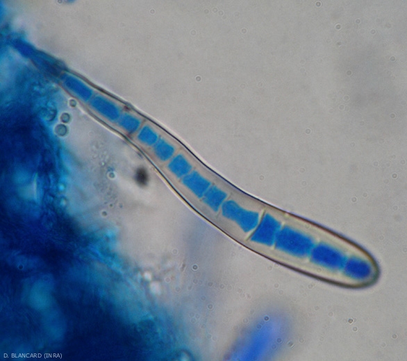 Cette conidie de Coynespora cassiicola est allongée, hyaline et présente plus de 10 pseudo-cloisons.
(corynesporiose)