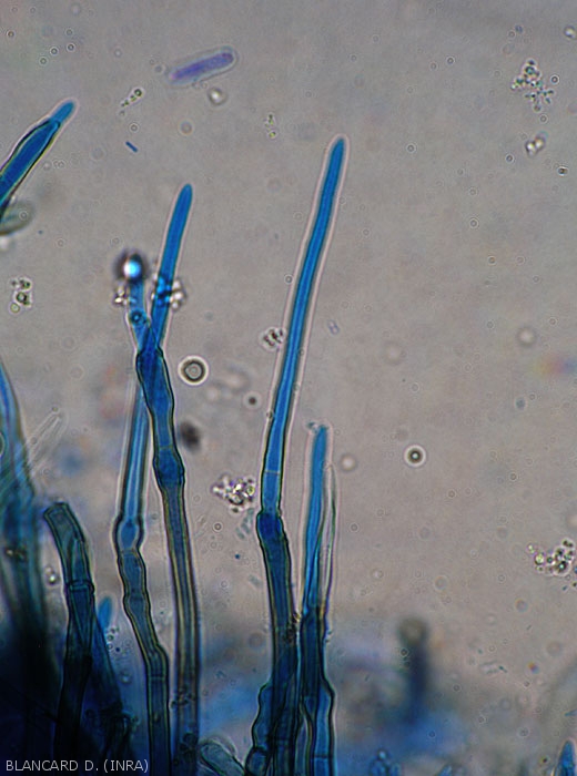 Detail of a young conidium forming at the tip of a melanized conidiophore.  Note the presence of a few transverse septa at the base of the spore.  <i>Cercospora</i> sp. 