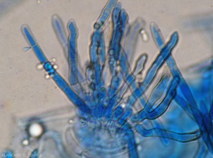 Detail of conidiophores emerging from a stomata present on this portion of leaf observed under a light microscope.  A few young septate conidia are forming.  <i>Pseudocercospora fuligena</i> (cercospora leaf spot)