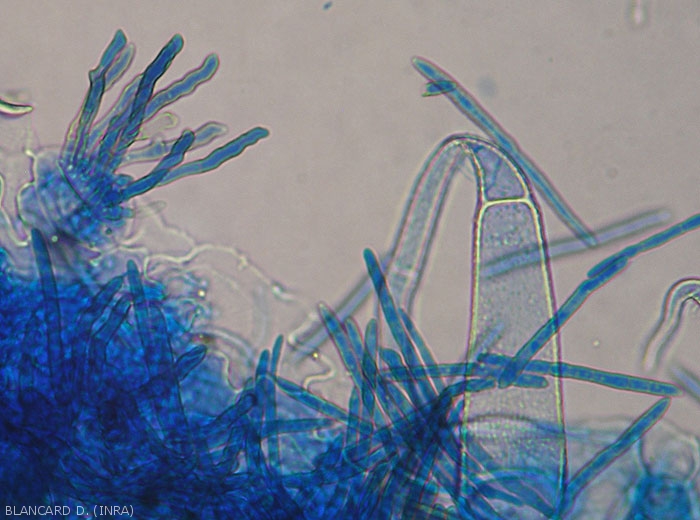 Several conidiophores emerging from a stomata and conidia are present on this leaf portion observed under a light microscope.
 <i>Pseudocercospora fuligena</i> (cercospora leaf spot)