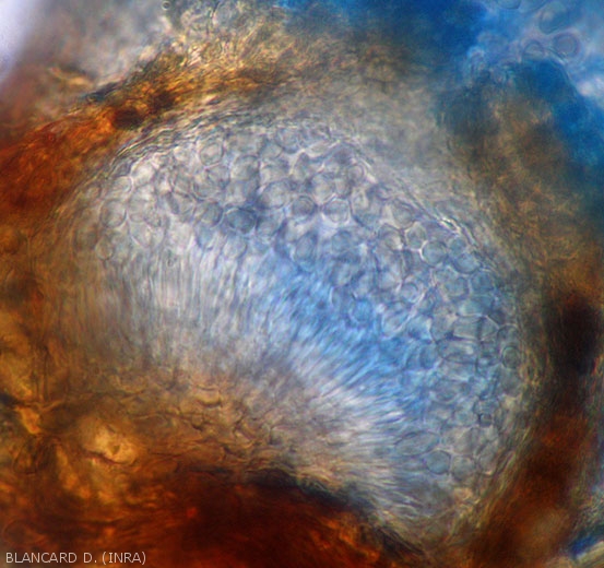 Sectional view of a <i><b>Pilidiella diplodiella</i></b> pycnidia.  We can clearly distinguish parallel conidiophores and young conidia (white rot).