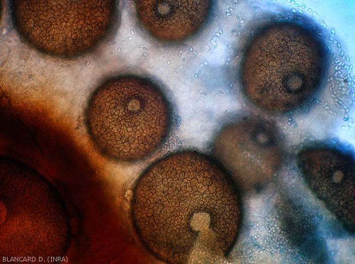 Under the light microscope the central ostiole of the subglobular pycnidia is clearly visible.  <i> <b> Pilidiella diplodiella </b> </i> (white rot)