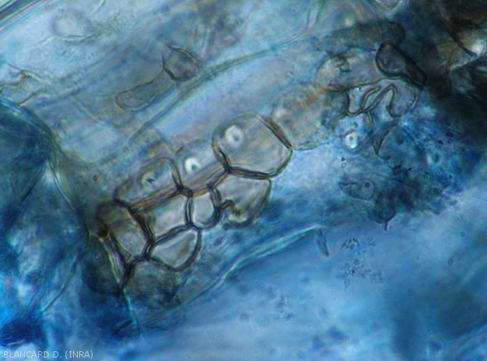 Outline of a microsclerotia of <b><i>Colletotrichum coccodes</i></b> forming in a cell of the cortex.