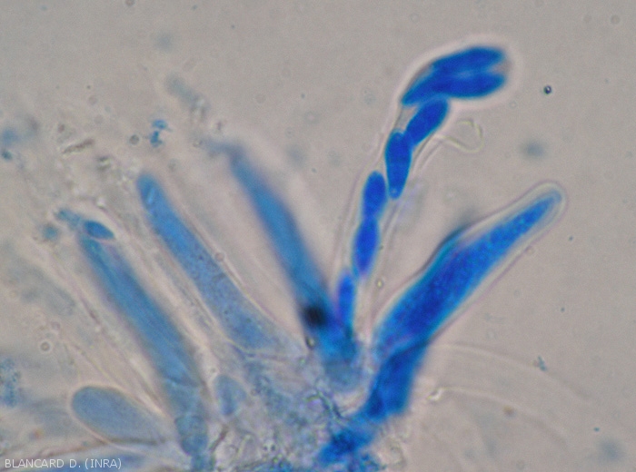 Bouquet of asci of <i><b>Didymella bryoniae</b></i>;  in one of them 8 elongated ascospores can be distinguished.  (teleomorph form)(black rot)