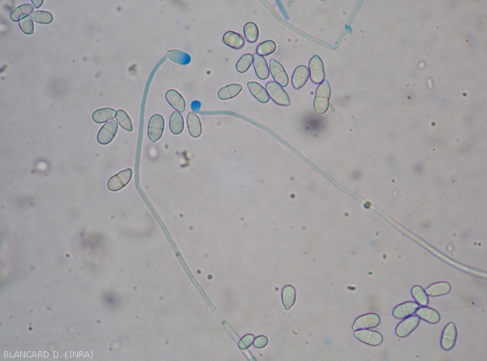 Appearance under a light microscope of conidiophores and conidia of <i> <b> Trichothecium roseum </b> </i>.  (pink mold)