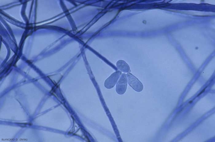 A few basipetally formed conidia are present at the tip of this young conidiophore. <i> T <b> richothecium roseum </b> </i> (pink mold)