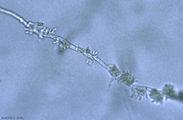 <i> <b> Aureobasidium pullulans </b> </i> blastoconidia are produced in a tuft from denticles.