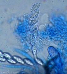 This ascus of <i> Botryosphaeria parva </i> contains 8 hyaline, non-septate ascospores measuring 18/27 × 8/11 µm.  Later, they will turn light brown and show 1 to 2 partitions (teleomorph of <i> Neofusicoccum parvum </i>).