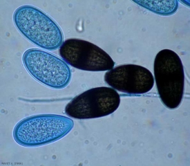 The conidia of <i> Lasiodiplodia theobromae </i> have the following dimensions: 24/28 × 12/15 µm.  They are initially hyaline and not septate, and become dark brown, with a septum and irregular longitudinal striations.  (anamorph of <i> <b> Botryosphaeria rhodina </b> </i>)