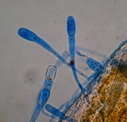 Young conidia formed at the tips of the conidiophores. <i> <b> Erysiphe necator </b> </i> (powdery mildew)