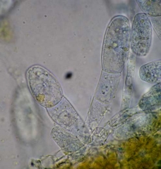 The conidiophores of <i> <b> Erysiphe necator </b> </i> are here quite short.  Like the conidia they carry, they are hyaline and septate.  (powdery mildew)