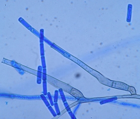 Elongated phialides and chain endoconidia of <i> <b> Thielaviopsis basicola </b> </i>.  (black rot)