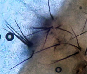 Observation under a light microscope makes it possible to better distinguish the acervuli.  They all have several brown, septate bristles, and the spores are clumped together in the form of mucus.
 <i> <b> Colletotrichum orbiculare </b> </i> (anthracnose)