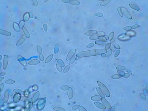 The conidia of <i> <b> Cladosporium cucumerinum </b> </i> are oblong, spindle-shaped, aseptic, rarely 1 to 2-septate;  they then measure 4.6-5.7 x 16.4-22.5 µm.