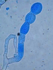 Three short-chain conidia formed at the end of a short conidiophore of <i> <b> Podosphaera xanthii </b> </i>.  (powdery mildew)