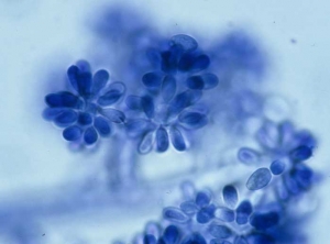 Conidia form at the end of the conidiophores where there is a bulb-shaped bulge.  They are carried by a sterigma, have an ovoid to elliptical shape and a hyaline to slightly pigmented coloration (6-18 x 4-11 µm).  <b> <i> Botrytis cinerea </i> </b> (gray mold)