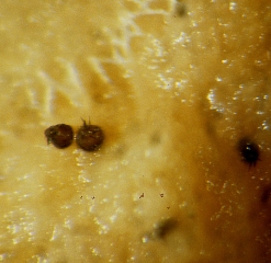 Aspect with a binocular magnifying glass of some pycnidia of <i> <b> Pyrenochaeta lycopersici </b> </i> formed on roots.  (corky roots)