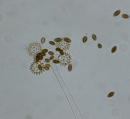 Observation under an optical microscope makes it possible to distinguish the primary and secondary vesicles which partly constitute the sporocyst.  <i> <b> Choanephora cucurbitarum </b> </i>