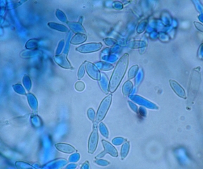 Morphological diversity of <i> <b> Cladosporium cucumerinum </b> </i> spores.  (cladospriosis)