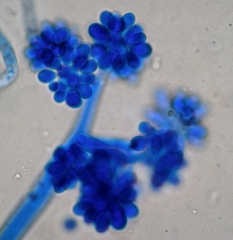 The conidiophores of <i> <b> Botrytis cinerea </b> </i> are bushy and produce hyaline and ovoid spores.  (gray mold)