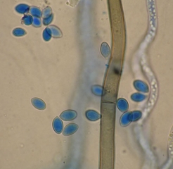 Ovoid, hyaline to slightly brownish conidia of <i> <b> Botrytis cinerea </b> </i>.  Mycelium is also visible.  (gray rot)