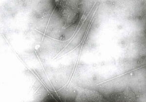 Flexuous viral particles of potato virus Y (PVY) are of 705 to 759 nm long and 12 nm in diameter.
