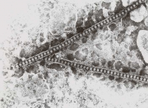 The viral particles of the ring spot virus in tobacco (Tobacco ring spot virus, TRSV) are polyhedral, from 28 to 30 nm in diameter.