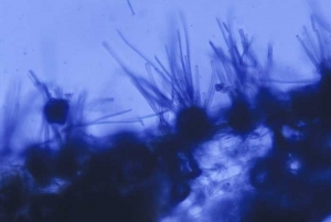 From the black clusters collected on the leaves, elongated conidia of the fungus are observed. <b><i>Cercospora nicotianae</i></b> (<i>Cercospora</i> disease, frog-eye)