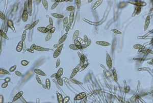<i><b>Alternaria alternata</b></i> (brown spot) produces a multitude of multicellular conidia, arranged in chains on relatively short conidiophores.