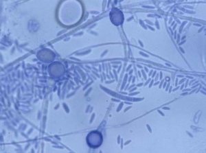 Chlamydospores_Fusarium