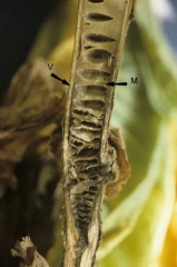 In some cases it may be interesting to check the conditions of the pith as well. It is sometimes altered and/or retracted, looking like a stack of discs. <i><b>Phytophthora nicotianae</i></b>