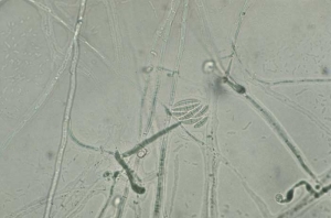 <b><i>Fusarium oxysporum </i>f. sp. <i>nicotianae</i> </b> (fusarium wilt) produces on short conidiophores, curved, elongated multicellular macroconidia. It is also produces unicellular microconidia and chlamydospores.

