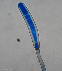 Une jeune conidie colorée en bleu  s'est formée à l'extrémité de conidiophores mélanisé de  Corynespora cassiicola.
(corynesporiose)