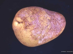 Tuber infected by violet root rot (<b><i>Rhizoctonia crocorum</b></i>), bearing purplish mycelium hypha and evolving into rot.