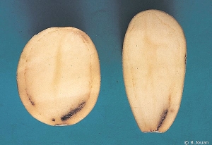 Browning of the vascular ring, more pronounced at the stem-end of the tuber. <b><i>Verticillium</i> sp.</b> (Verticillium wilt)