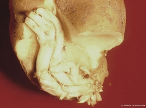 Development of sprouts within the potato tuber