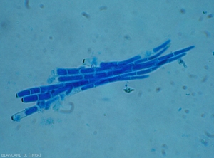 The conidia of <i>Cercospora citrulina</i> are solitary, hyaline;  straight to slightly curved, with 1 to 16 septa;  their length varies from 20 to 270 micrometers.