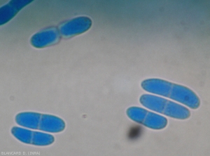 Light microscope detail of septate and bicellular conidia of <b><i>Phoma cucurbitacearum</i></b>.  (anamorphic form)(black rot, black rot)