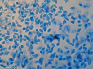 Appearance of young conidia of <b><i>Phoma cucurbitacearum</i></b> (anamorph form)(black rot, black rot)