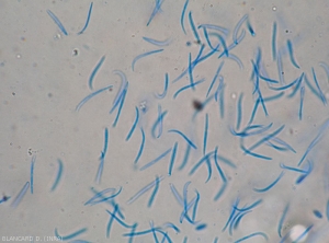 Aspect under the light microscope of a beta spore cirrh of <b><i>Phomopsis vexans</i></b>.