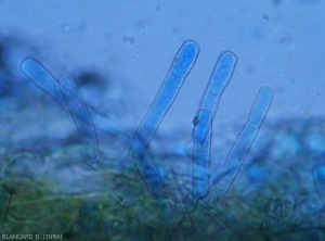 Aspect of several conidiophores produced by <b><i>Oidium neolycopersici</i></b> and observed under a light microscope.  <b>External powdery mildew (powdery mildew, white mold)</b>