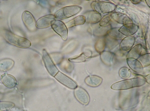 Numerous irregular conidia, sometimes septate and brownish, are observed on the lamina.  <b><i>Passalora fulva</i></b> (cladosporiosis, leaf mold)