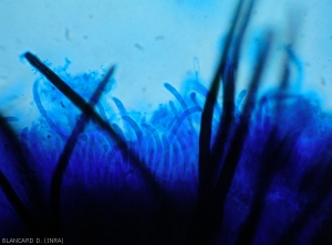 Acervulus produced by a <i><b>Colletotrichum</i> sp.</b> seen in section under a light microscope.  Note the presence of numerous elongated and arcuate conidia.  (anthracnose)