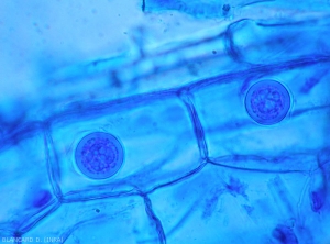 Appearance of oospores of <b><i>Pythium</i> sp.</b> observed under a light microscope.  (Oomycetes)