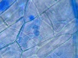 Young lobed sporangium of <i>Pythium aphanidermatum</i> visible in the damaged root tissues of cucumber roots.  (Oomycetes)