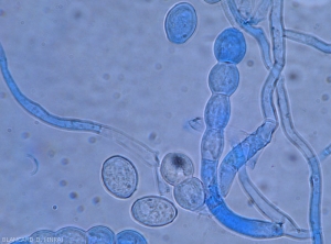 Three conidia form the beginning of a chain at the end of a short conidiophore of <i><b>Podosphaera xanthii</b></i>.  (oidium)