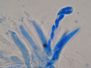 Bouquet of asci of <i><b>Didymella bryoniae</b></i>;  in one of them 8 elongated ascospores can be distinguished.  (teleomorph form)(black rot)