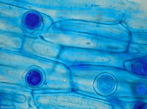 Oospores-Pythium-Pois