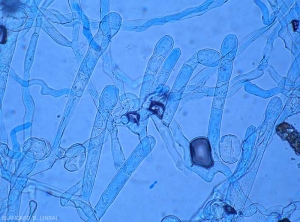 Appearance of several short conidiophores of <i><b>Podosphaera xanthii</b></i>.  (oidium)