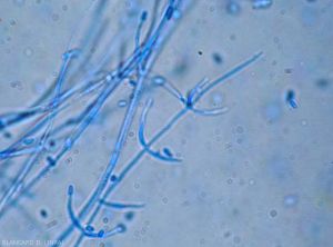 Verticillium-Conidiophores